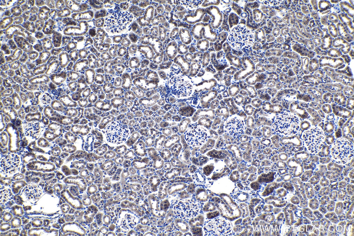 Immunohistochemistry (IHC) staining of rat kidney tissue using PDSS2 Polyclonal antibody (13544-1-AP)