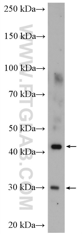 Western Blot (WB) analysis of A375 cells using PDSS2 Polyclonal antibody (13544-1-AP)
