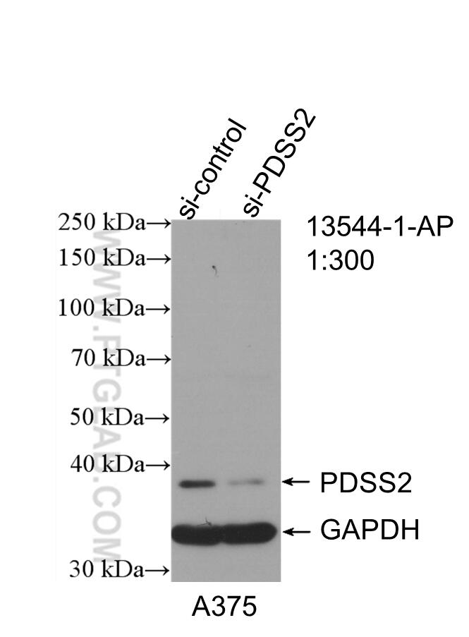 Western Blot (WB) analysis of A375 cells using PDSS2 Polyclonal antibody (13544-1-AP)