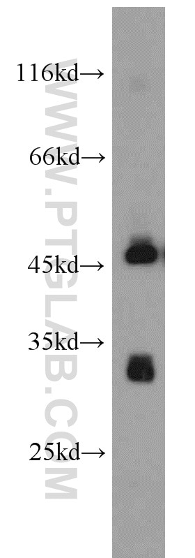 Western Blot (WB) analysis of SGC-7901 cells using PDSS2 Polyclonal antibody (13544-1-AP)