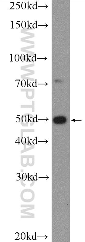 PDX1 Polyclonal antibody