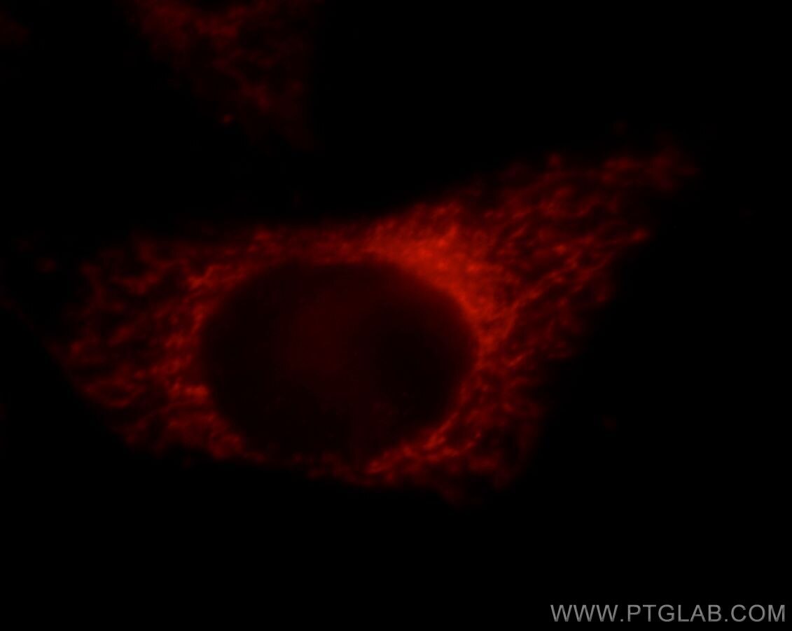 Immunofluorescence (IF) / fluorescent staining of HepG2 cells using PDXDC1 Polyclonal antibody (21021-1-AP)