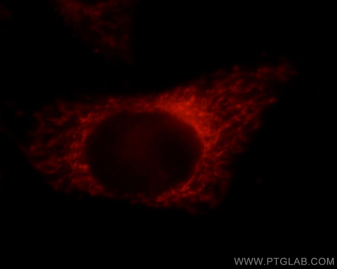 IF Staining of HepG2 using 21021-1-AP