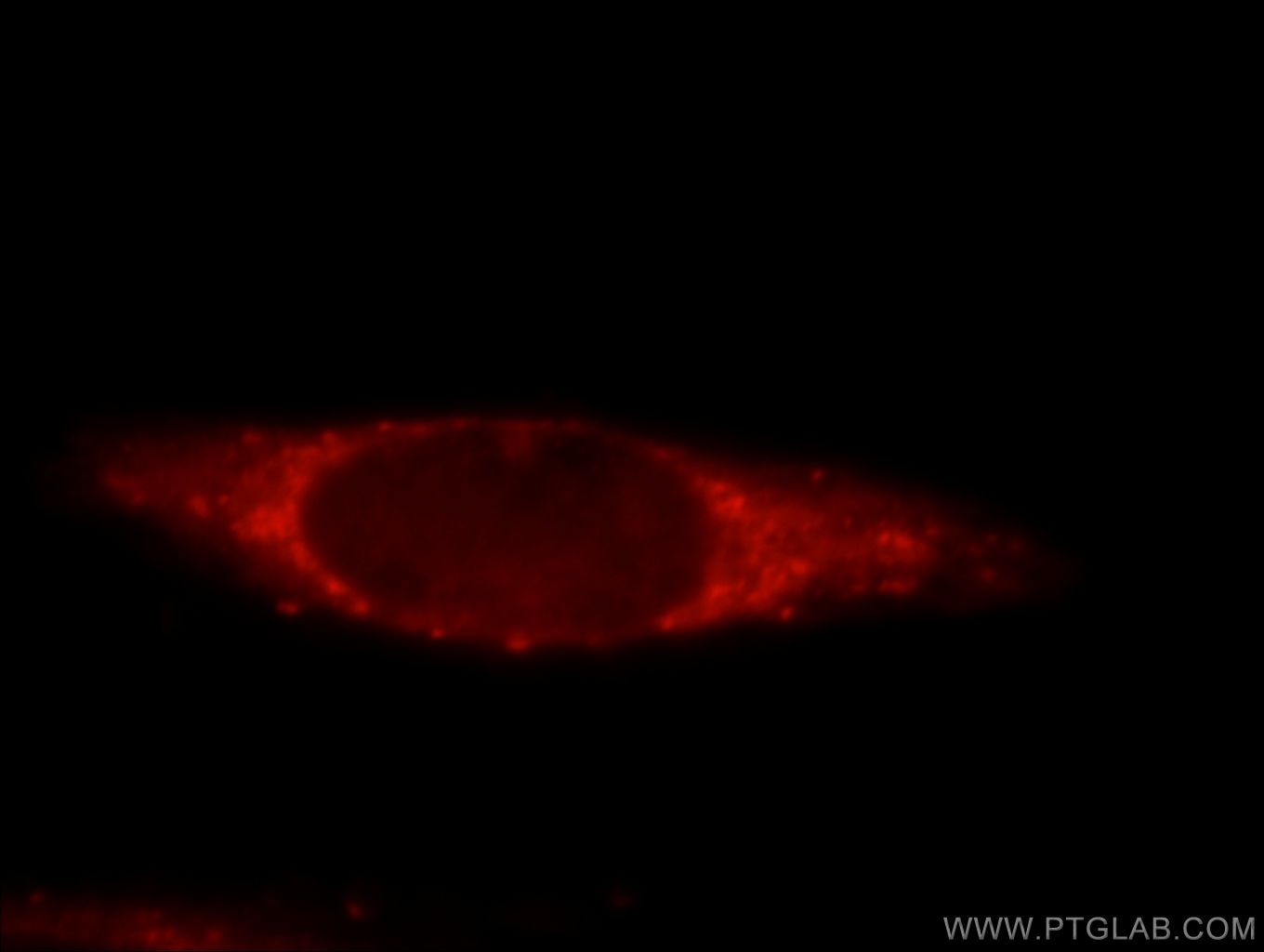 Immunofluorescence (IF) / fluorescent staining of HeLa cells using PDXDC1 Polyclonal antibody (21021-1-AP)
