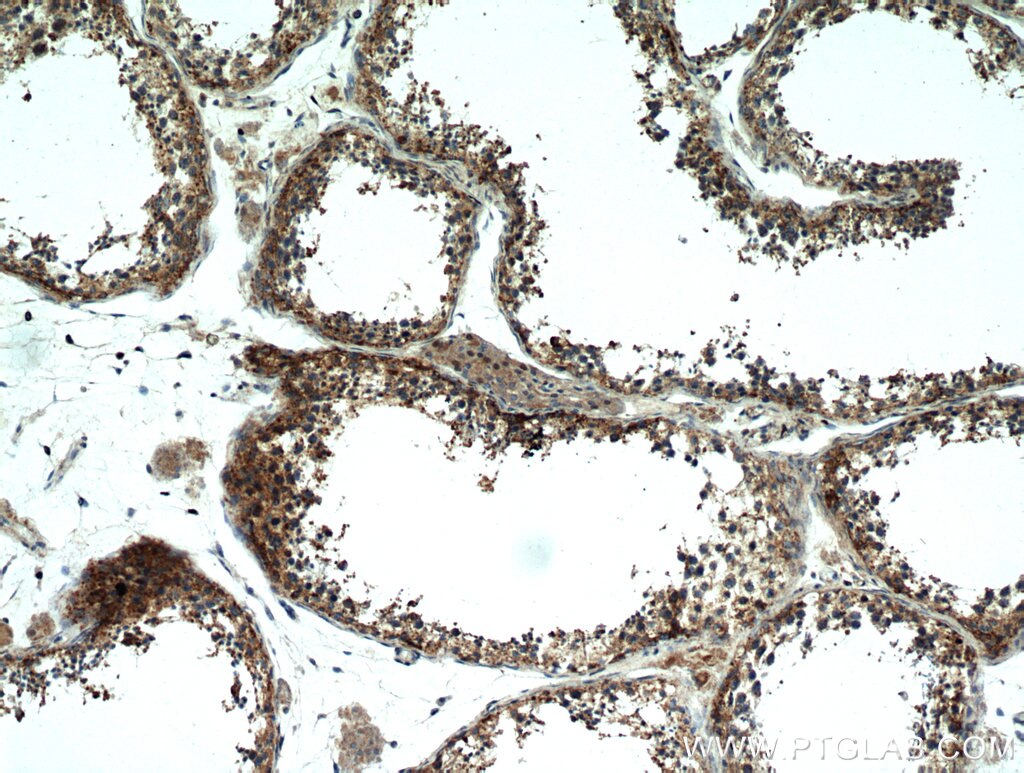 Immunohistochemistry (IHC) staining of human testis tissue using PDXDC1 Polyclonal antibody (21021-1-AP)