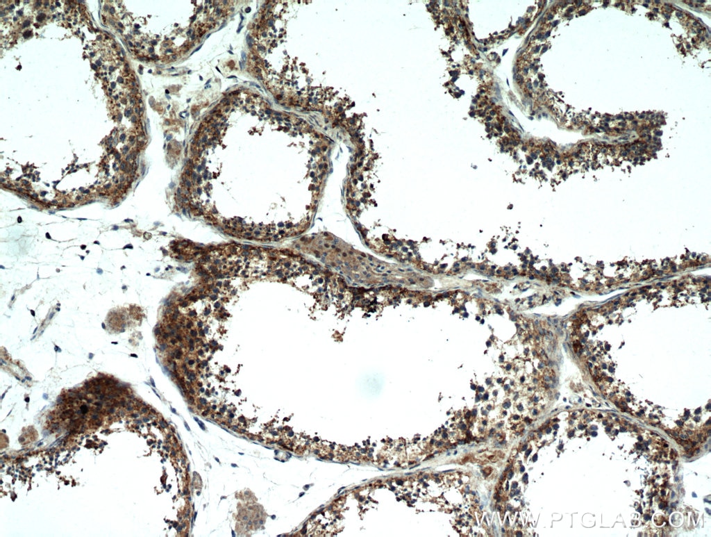 IHC staining of human testis using 21021-1-AP