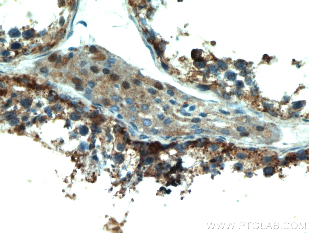 Immunohistochemistry (IHC) staining of human testis tissue using PDXDC1 Polyclonal antibody (21021-1-AP)