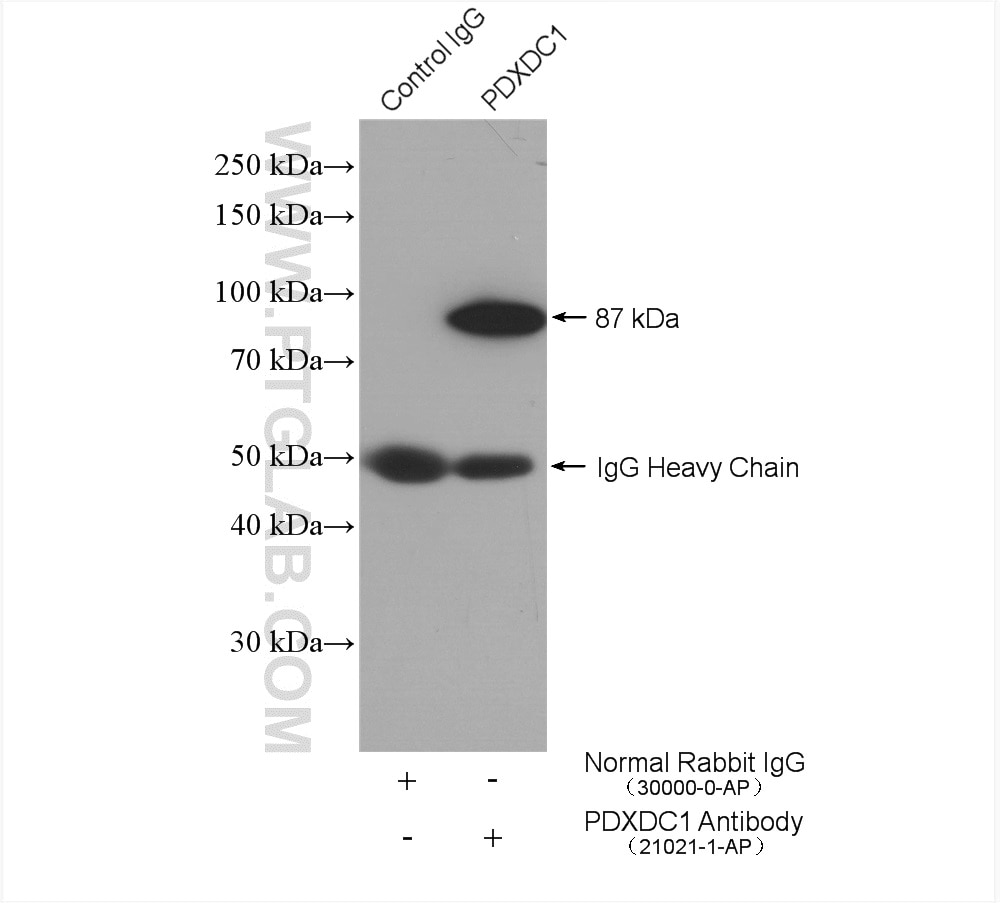 Immunoprecipitation (IP) experiment of HepG2 cells using PDXDC1 Polyclonal antibody (21021-1-AP)