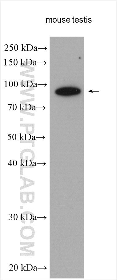Western Blot (WB) analysis of various lysates using PDXDC1 Polyclonal antibody (21021-1-AP)