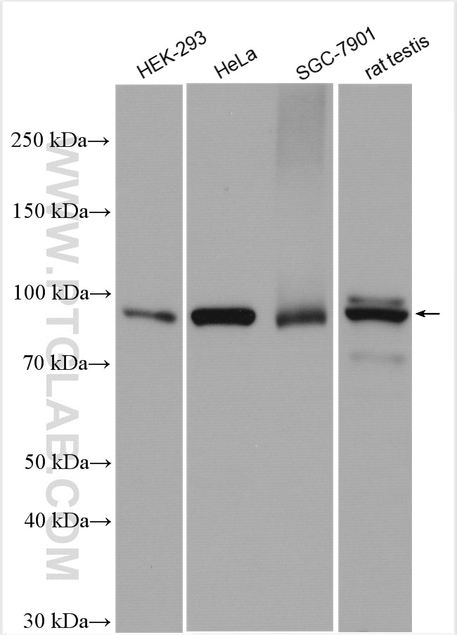 Western Blot (WB) analysis of various lysates using PDXDC1 Polyclonal antibody (21021-1-AP)