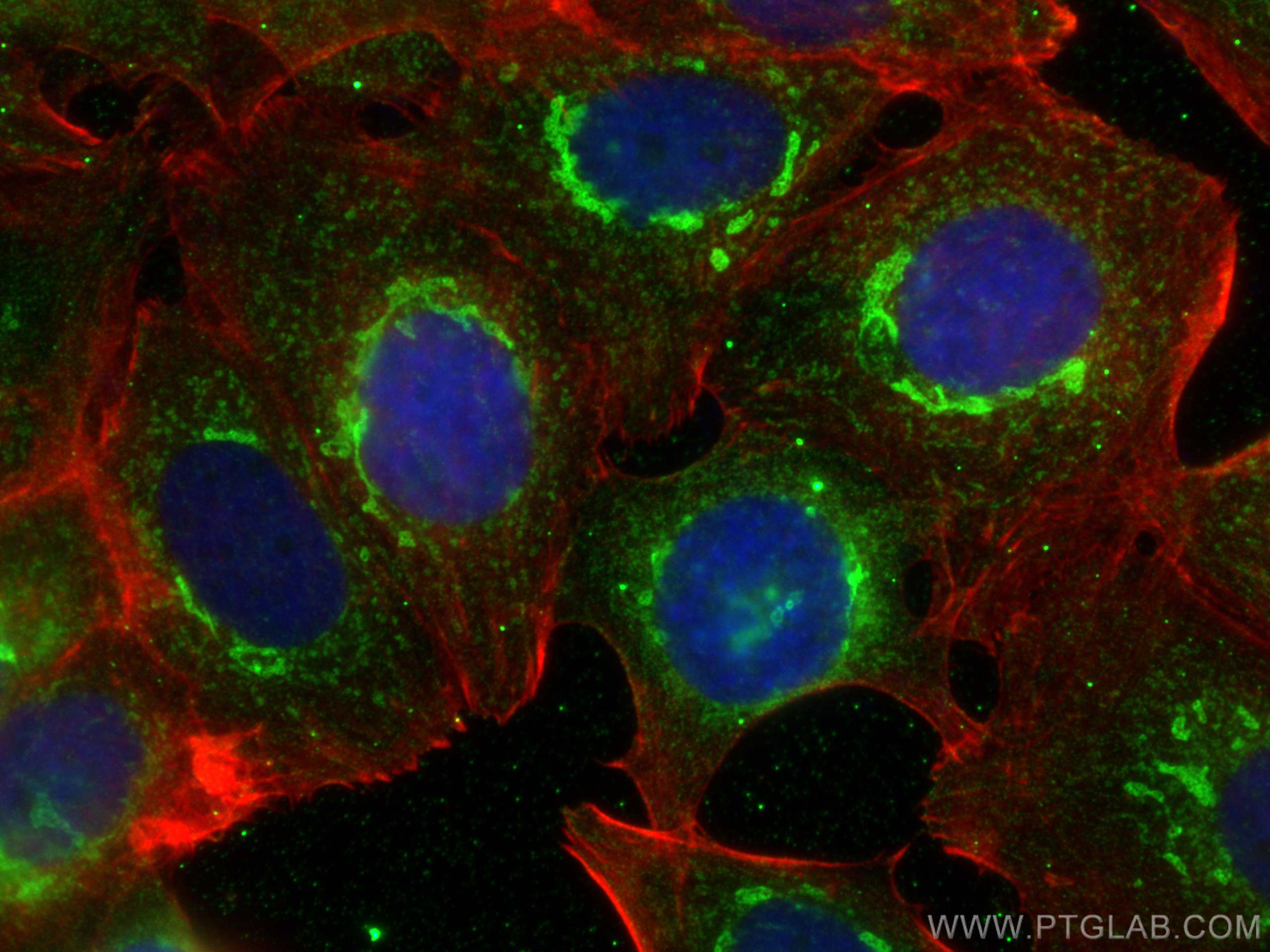 Immunofluorescence (IF) / fluorescent staining of MCF-7 cells using PDXDC1 Monoclonal antibody (68278-1-Ig)