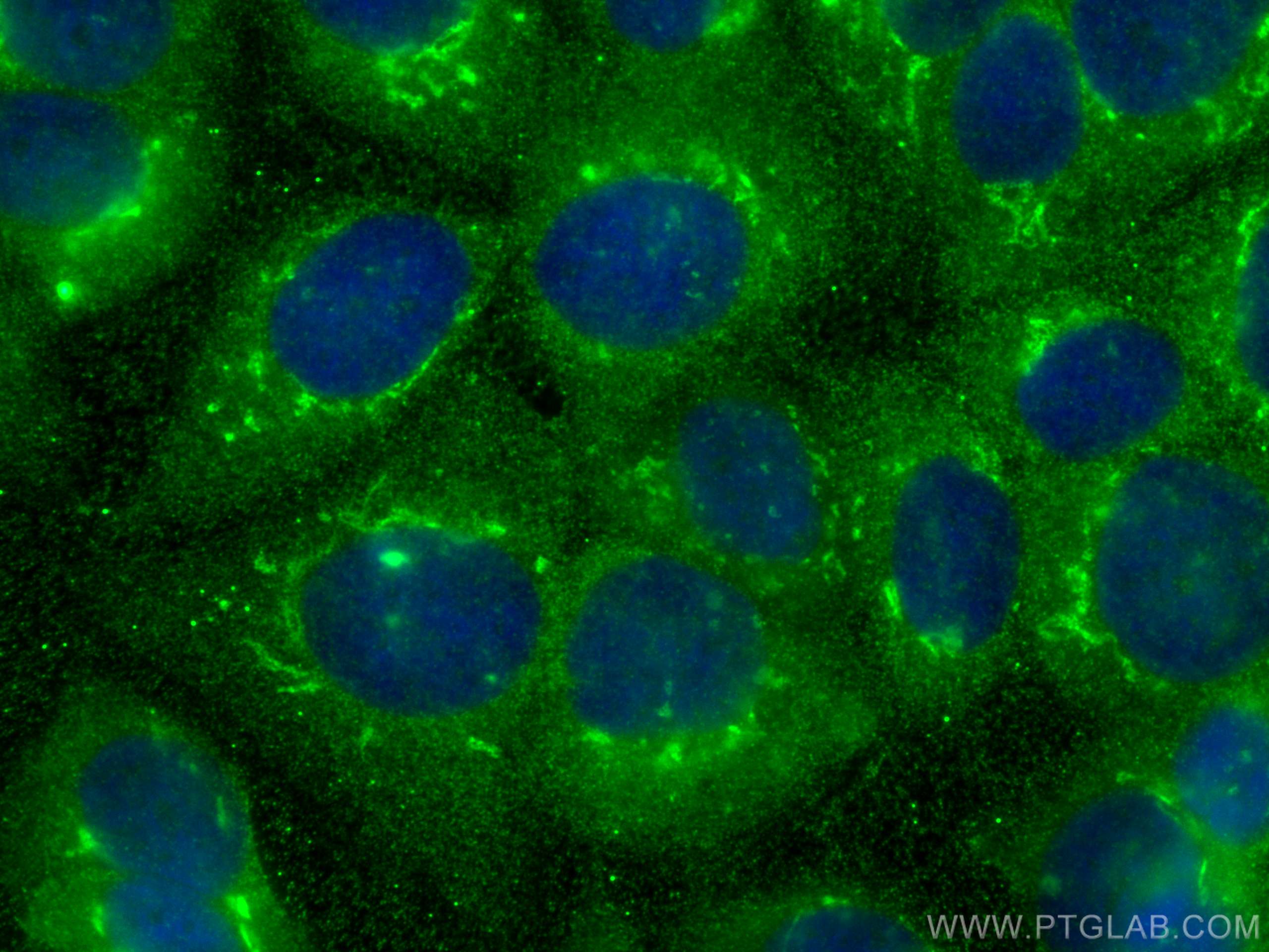 Immunofluorescence (IF) / fluorescent staining of MCF-7 cells using PDXDC1 Monoclonal antibody (68278-1-Ig)