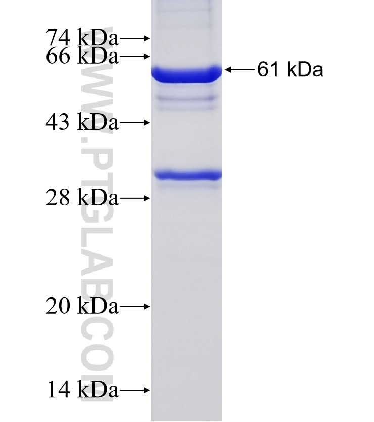 PDXDC1 fusion protein Ag15283 SDS-PAGE