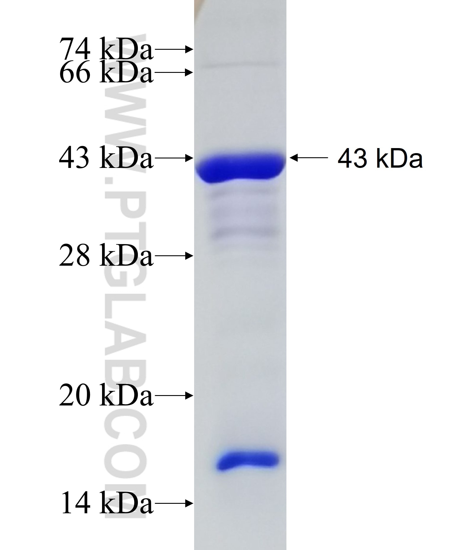 PDXDC1 fusion protein Ag15489 SDS-PAGE