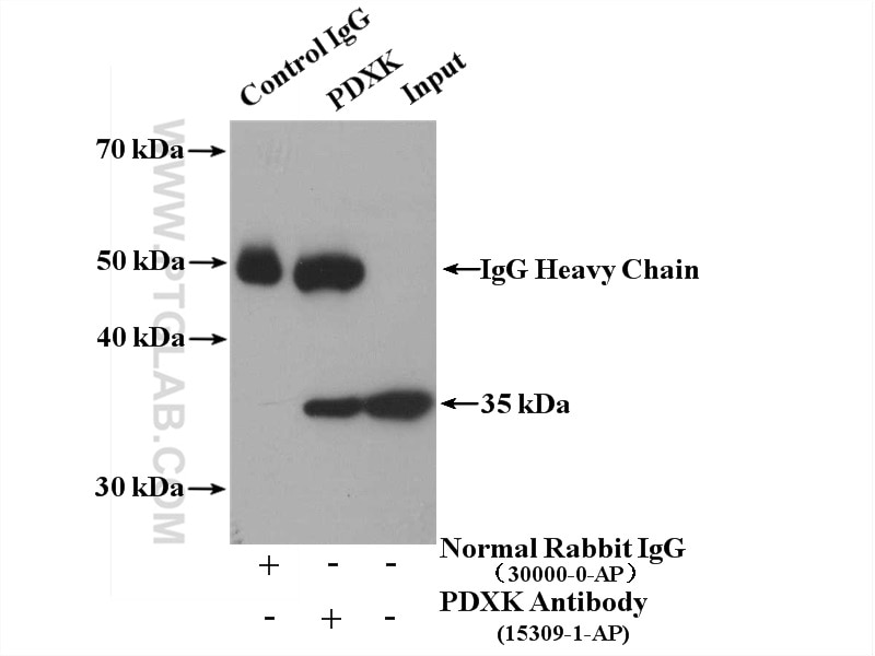 Immunoprecipitation (IP) experiment of mouse liver tissue using PDXK Polyclonal antibody (15309-1-AP)