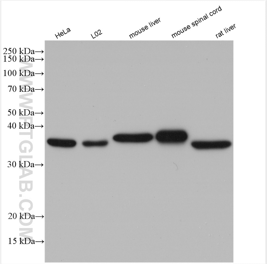 Western Blot (WB) analysis of various lysates using PDXK Polyclonal antibody (15309-1-AP)