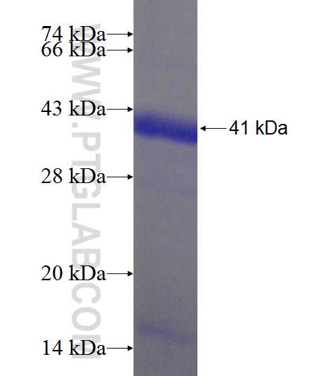 PDXK fusion protein Ag7686 SDS-PAGE