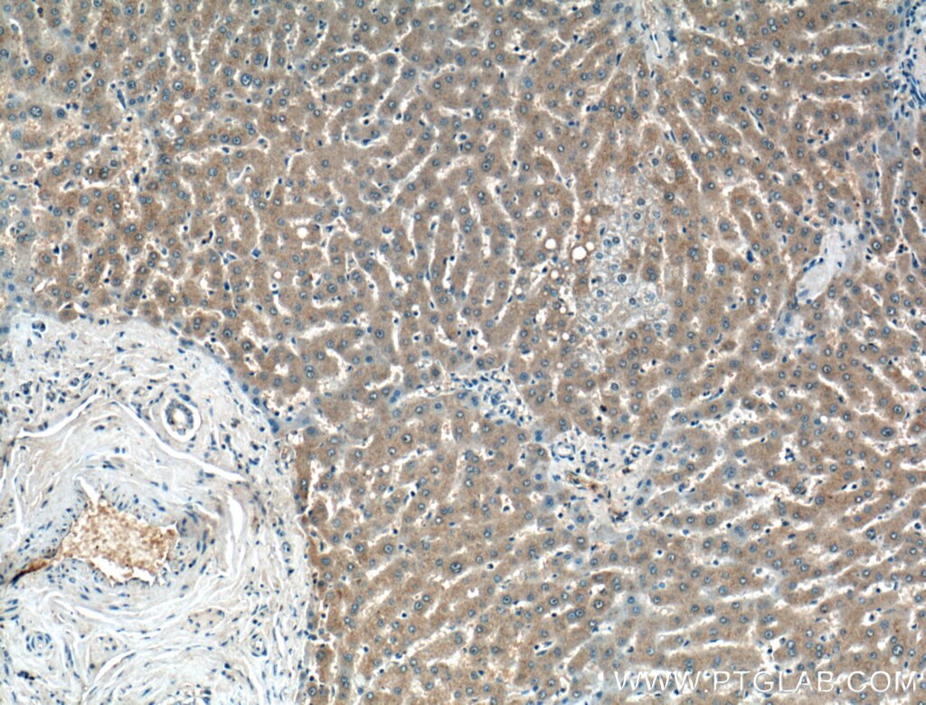 Immunohistochemistry (IHC) staining of human liver tissue using PDXP Polyclonal antibody (27490-1-AP)