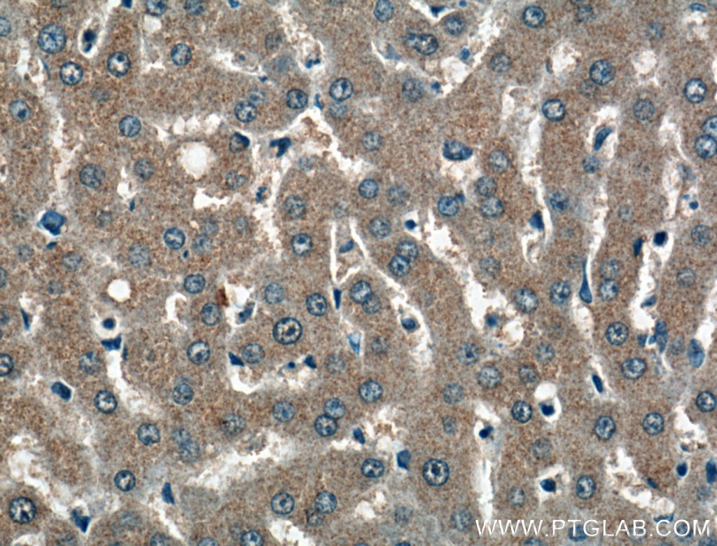 Immunohistochemistry (IHC) staining of human liver tissue using PDXP Polyclonal antibody (27490-1-AP)