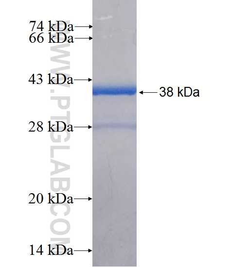 PDXP fusion protein Ag26592 SDS-PAGE