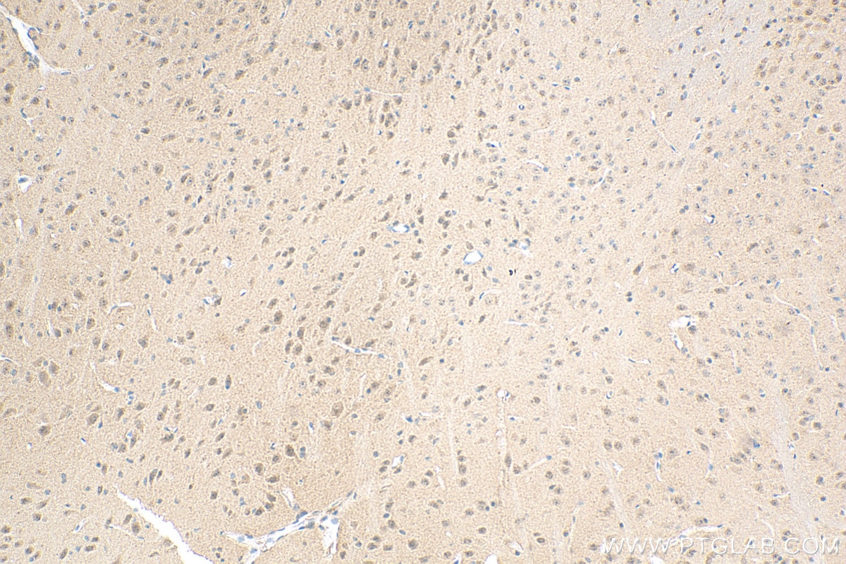 Immunohistochemistry (IHC) staining of mouse brain tissue using PDZ-GEF2 Polyclonal antibody (24583-1-AP)