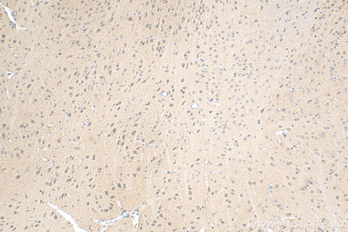 Immunohistochemistry (IHC) staining of mouse brain tissue using PDZ-GEF2 Polyclonal antibody (24583-1-AP)