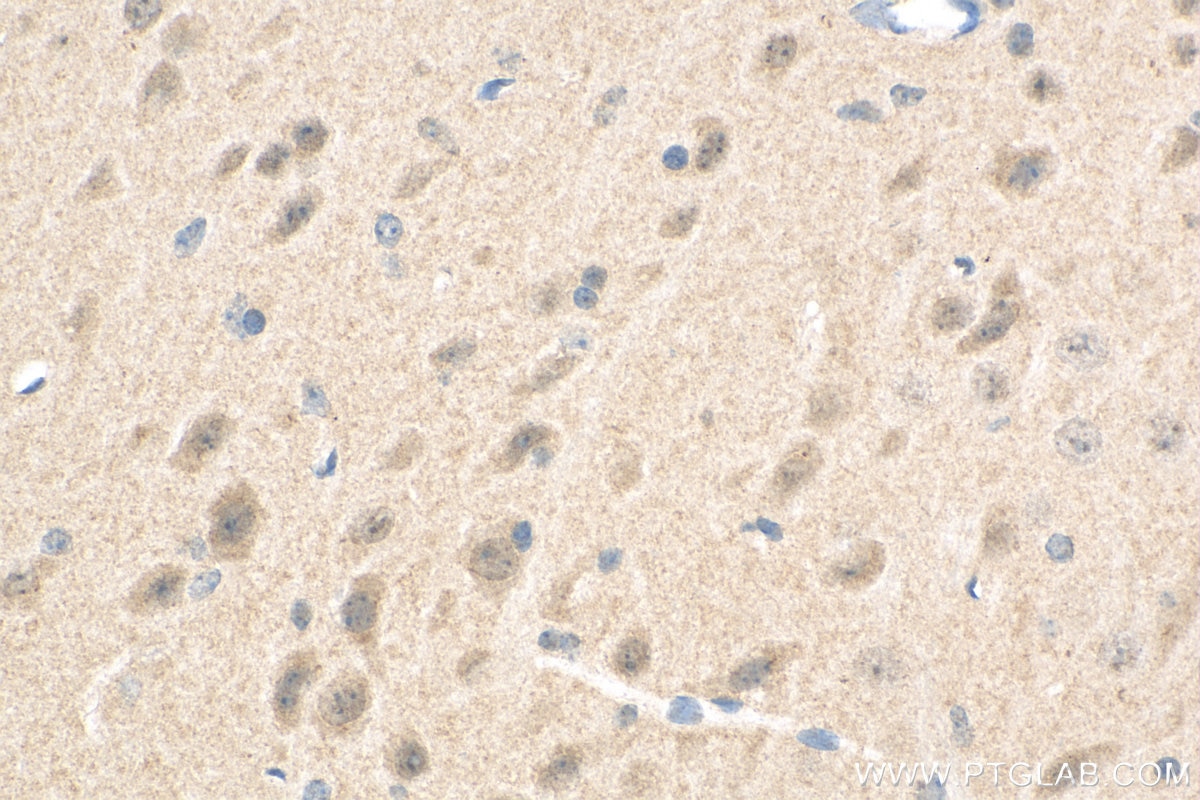 IHC staining of mouse brain using 24583-1-AP