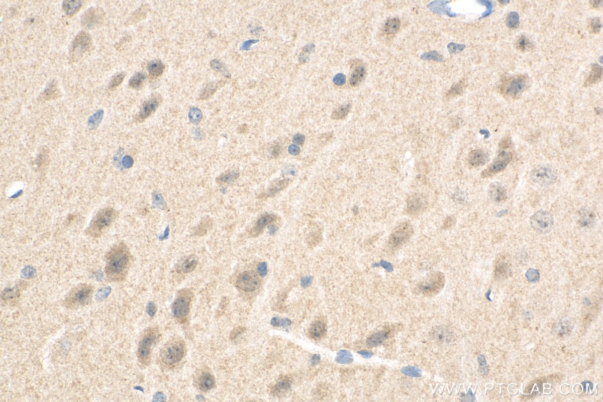 Immunohistochemistry (IHC) staining of mouse brain tissue using PDZ-GEF2 Polyclonal antibody (24583-1-AP)