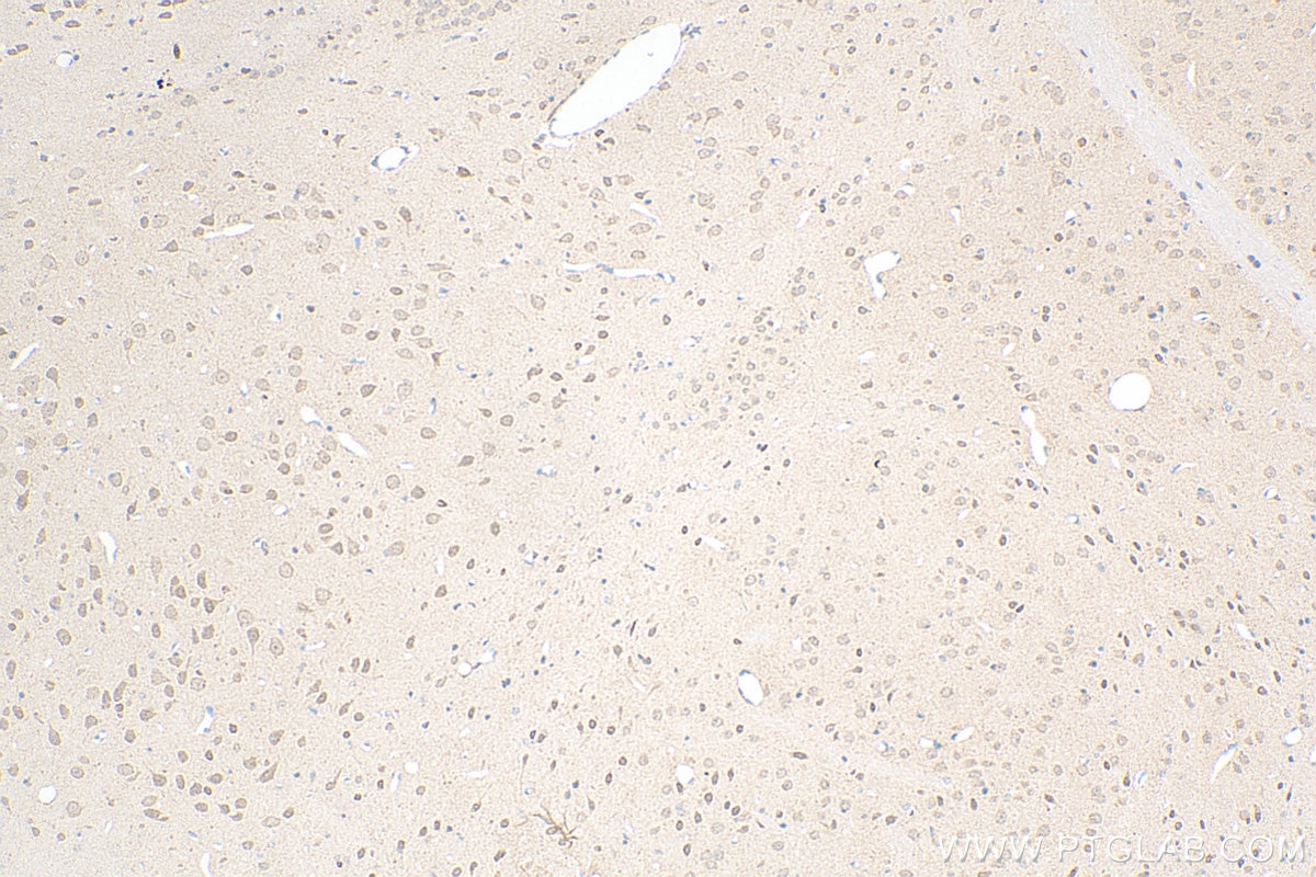 Immunohistochemistry (IHC) staining of rat brain tissue using PDZ-GEF2 Polyclonal antibody (24583-1-AP)