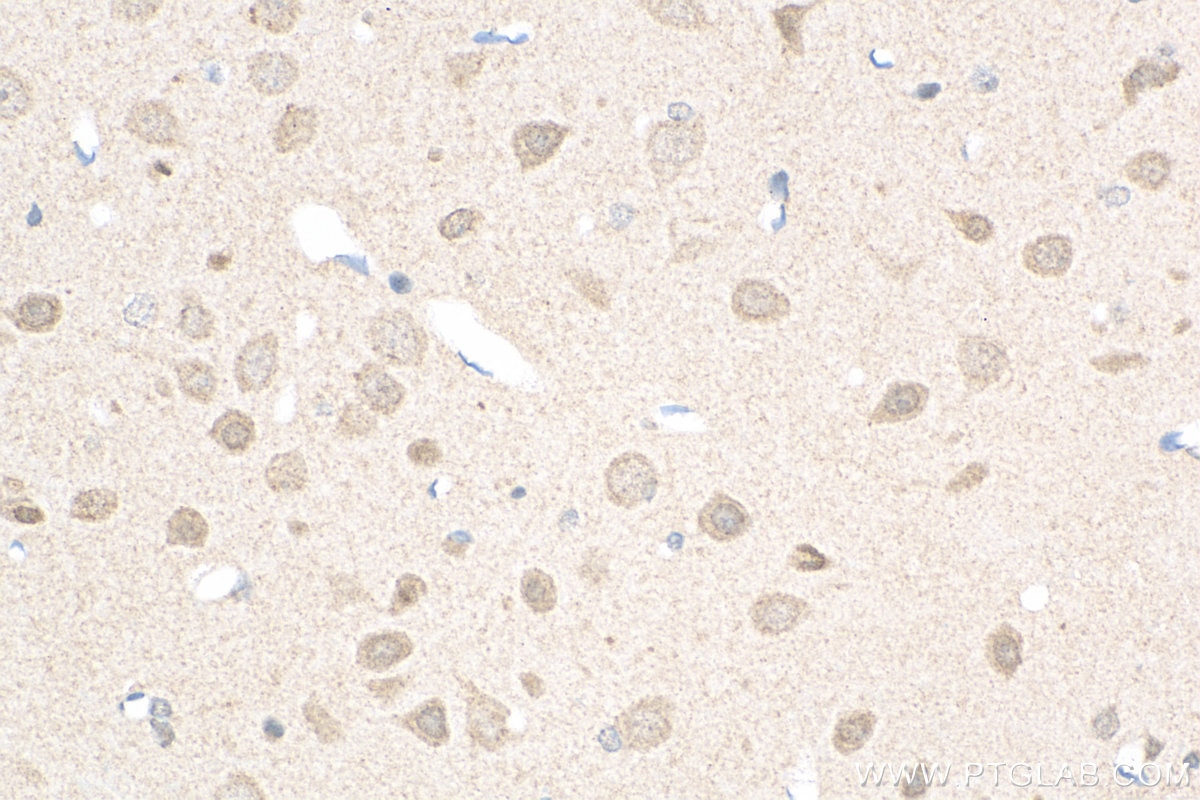 Immunohistochemistry (IHC) staining of rat brain tissue using PDZ-GEF2 Polyclonal antibody (24583-1-AP)
