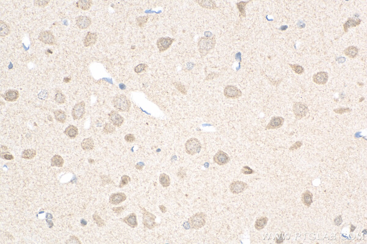 Immunohistochemistry (IHC) staining of rat brain tissue using PDZ-GEF2 Polyclonal antibody (24583-1-AP)