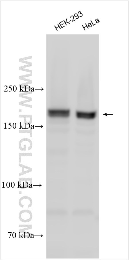 Western Blot (WB) analysis of various lysates using PDZ-GEF2 Polyclonal antibody (24583-1-AP)