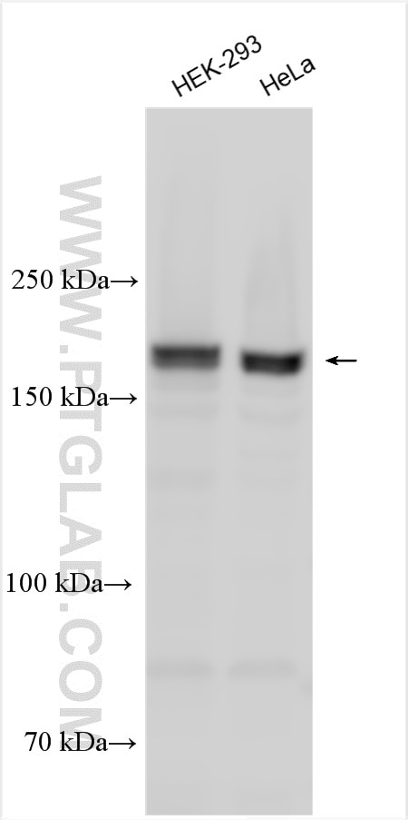 WB analysis using 24583-1-AP