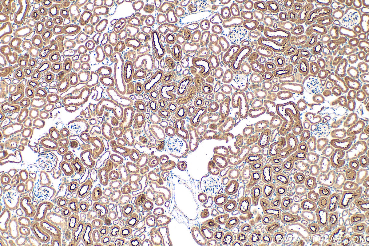 Immunohistochemistry (IHC) staining of mouse kidney tissue using PDZD11 Polyclonal antibody (26236-1-AP)