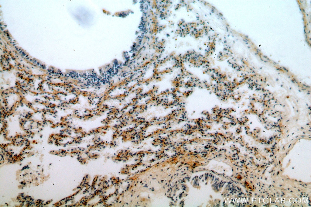 IHC staining of human lung using 20039-1-AP