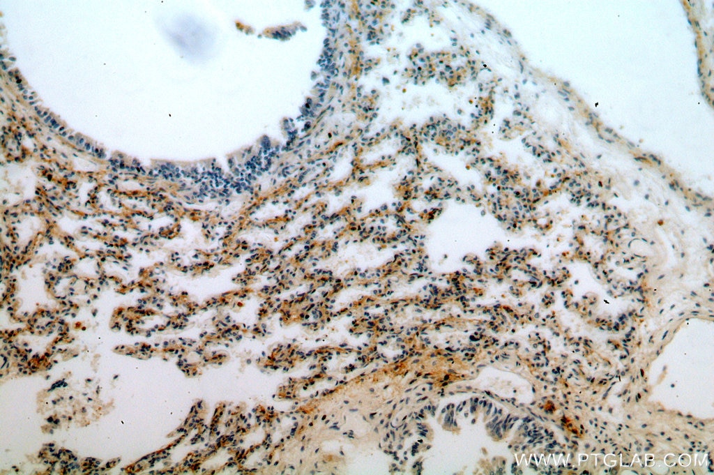 Immunohistochemistry (IHC) staining of human lung tissue using PDZD2 Polyclonal antibody (20039-1-AP)