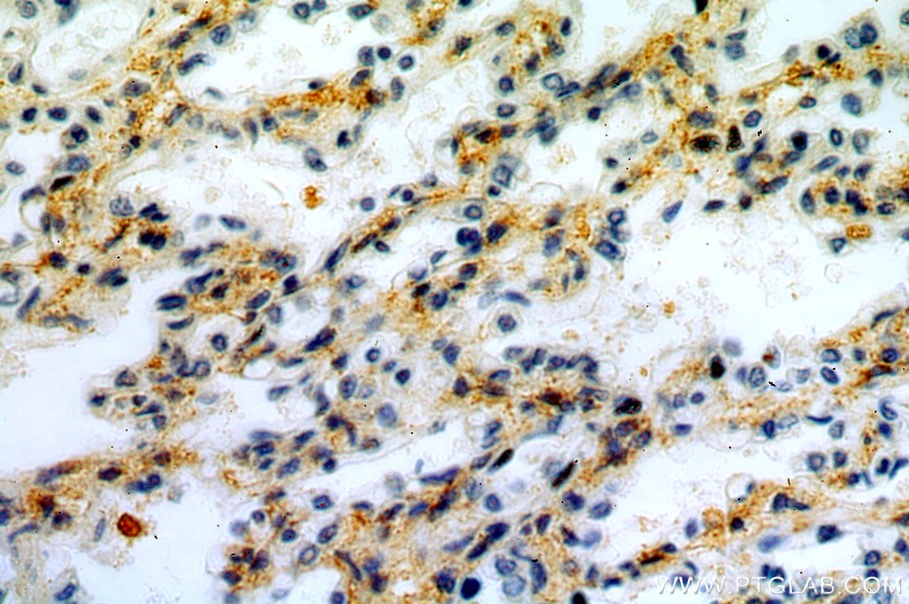 Immunohistochemistry (IHC) staining of human lung tissue using PDZD2 Polyclonal antibody (20039-1-AP)
