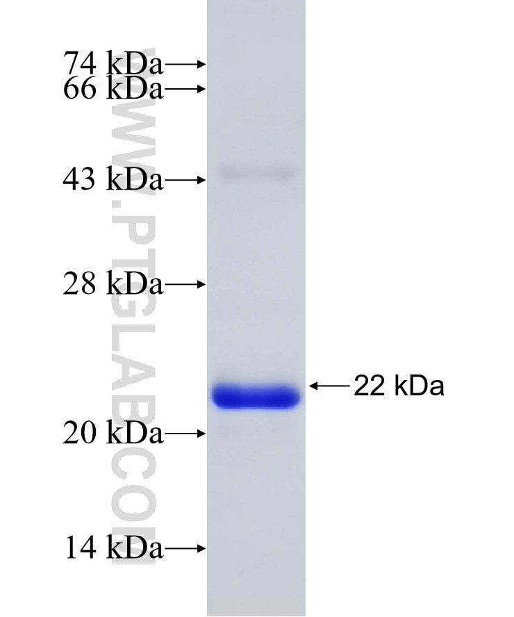PDZD2 fusion protein Ag31602 SDS-PAGE PDZD2 fusion protein Ag31602 SDS-PAGE