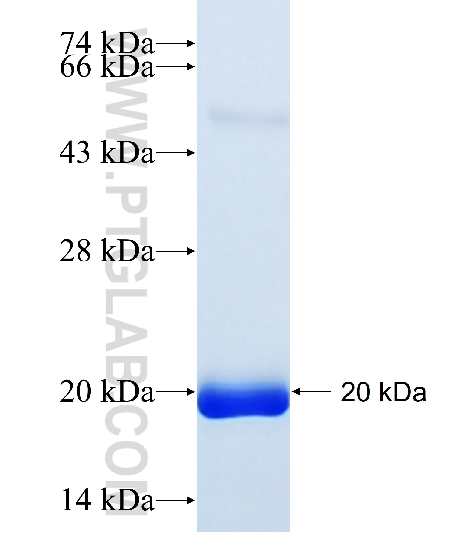 PDZD2 fusion protein Ag32913 SDS-PAGE PDZD2 fusion protein Ag32913 SDS-PAGE