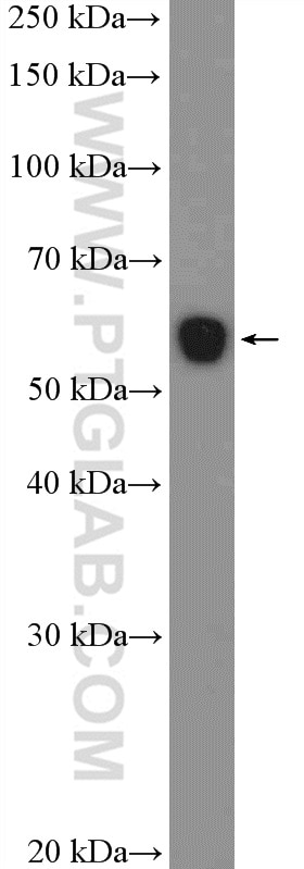 Western Blot (WB) analysis of rat kidney tissue using PDZD3 Polyclonal antibody (18795-1-AP)