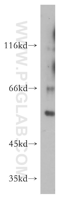 Western Blot (WB) analysis of mouse colon tissue using PDZD3 Polyclonal antibody (18795-1-AP)