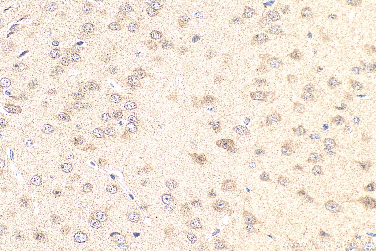 Immunohistochemistry (IHC) staining of mouse brain tissue using PDZD4 Polyclonal antibody (20167-1-AP)