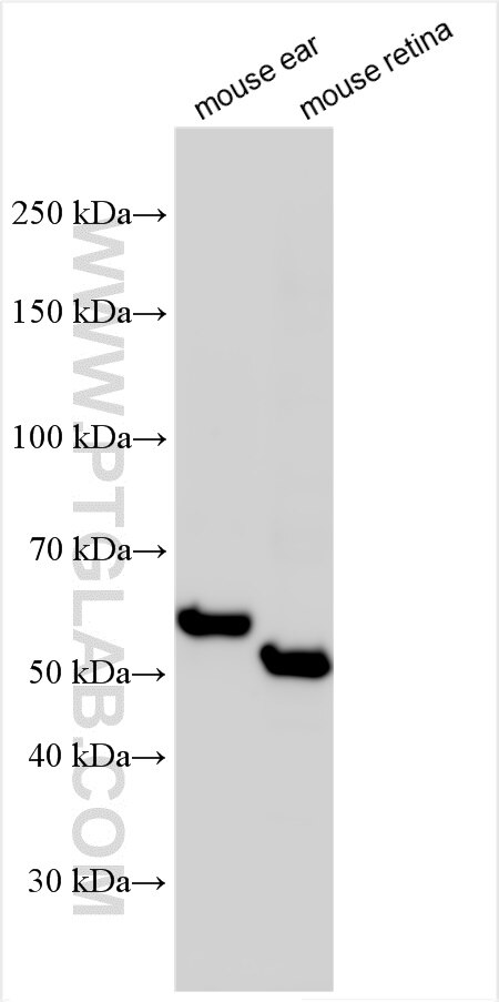 Western Blot (WB) analysis of various lysates using PDZD7 Polyclonal antibody (21084-1-AP)