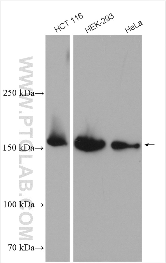 Western Blot (WB) analysis of various lysates using PDZD8 Polyclonal antibody (25512-1-AP)