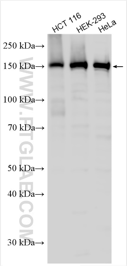 Western Blot (WB) analysis of various lysates using PDZD8 Polyclonal antibody (25512-1-AP)