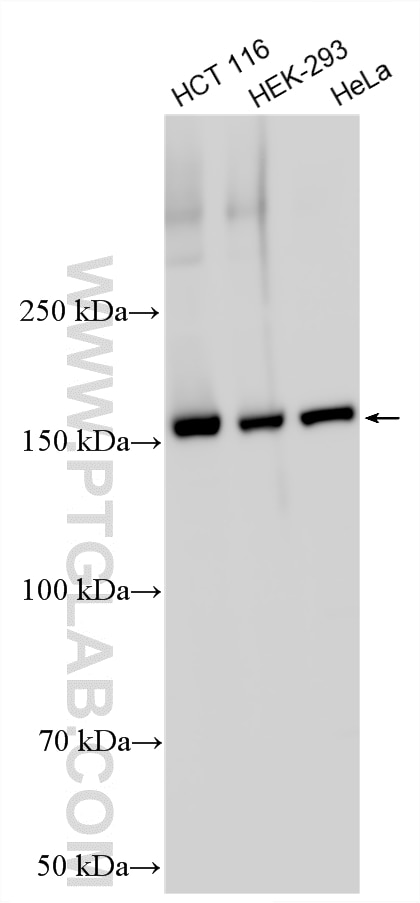 Western Blot (WB) analysis of various lysates using PDZD8 Polyclonal antibody (25512-1-AP)