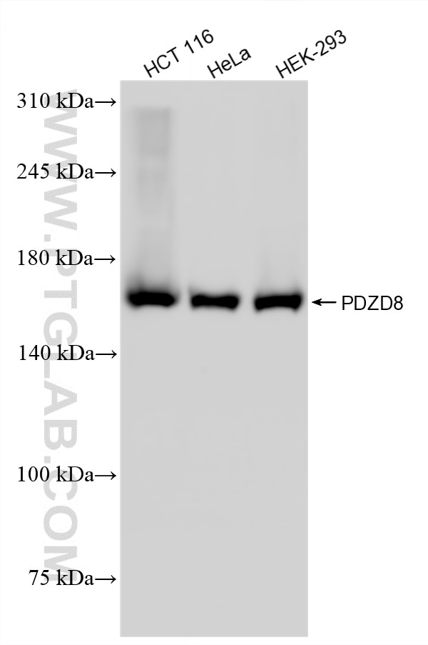 WB analysis using 87134-1-RR (same clone as 87134-1-PBS) Western Blot (WB) analysis of various lysates using PDZD8 Recombinant monoclonal antibody (87134-1-RR)