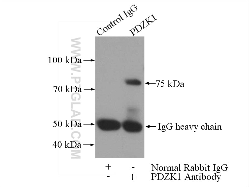 Immunoprecipitation (IP) experiment of HEK-293 cells using PDZK1 Polyclonal antibody (10507-2-AP)