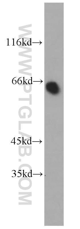 Western Blot (WB) analysis of mouse kidney tissue using PDZK1 Polyclonal antibody (10507-2-AP)