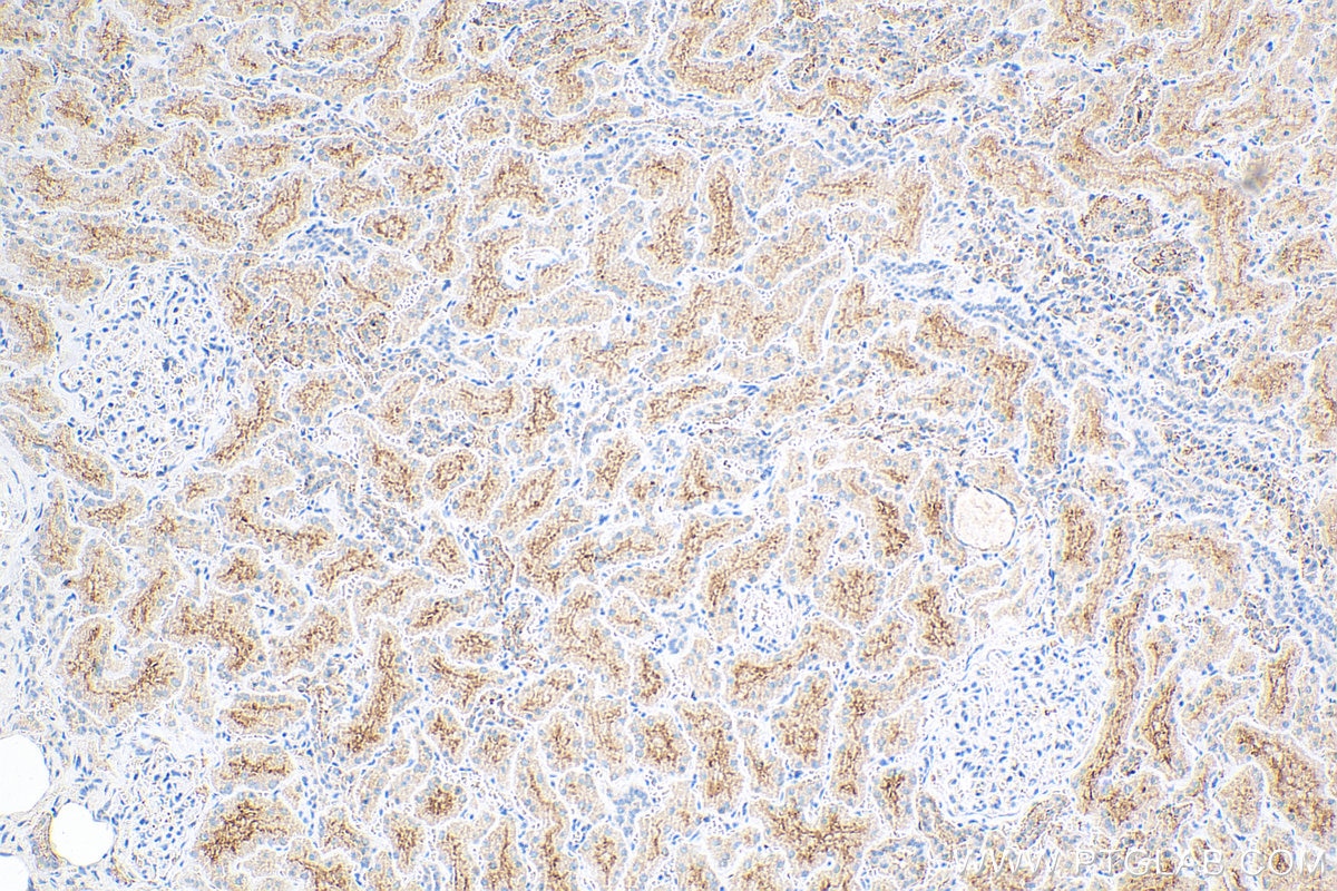 Immunohistochemistry (IHC) staining of human kidney tissue using MAP17 / PDZK1IP1 Polyclonal antibody (12518-1-AP)
